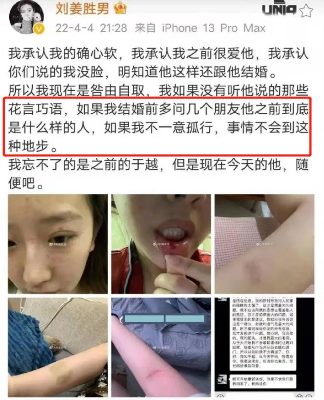 百万女网红家暴反转,男方痛诉她出轨堂弟还打我